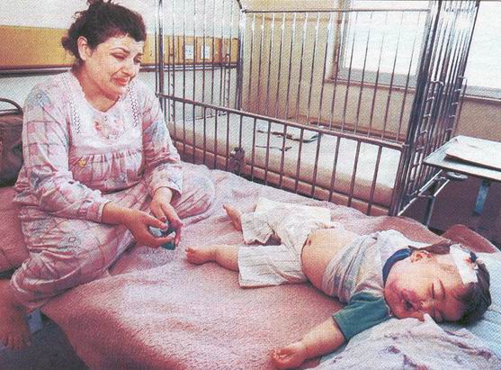 An iraqi woman grieves over her leukemia-stricken child in a Baghdad Hospital. -- AFP/Corbis